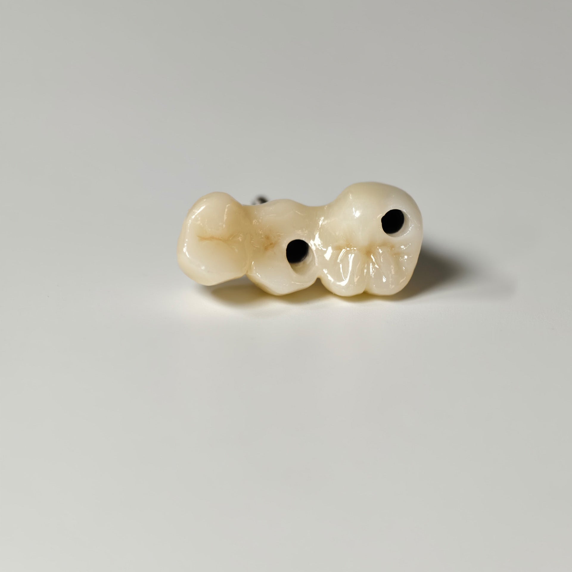 Zirconia Bridgewith Screw Retained