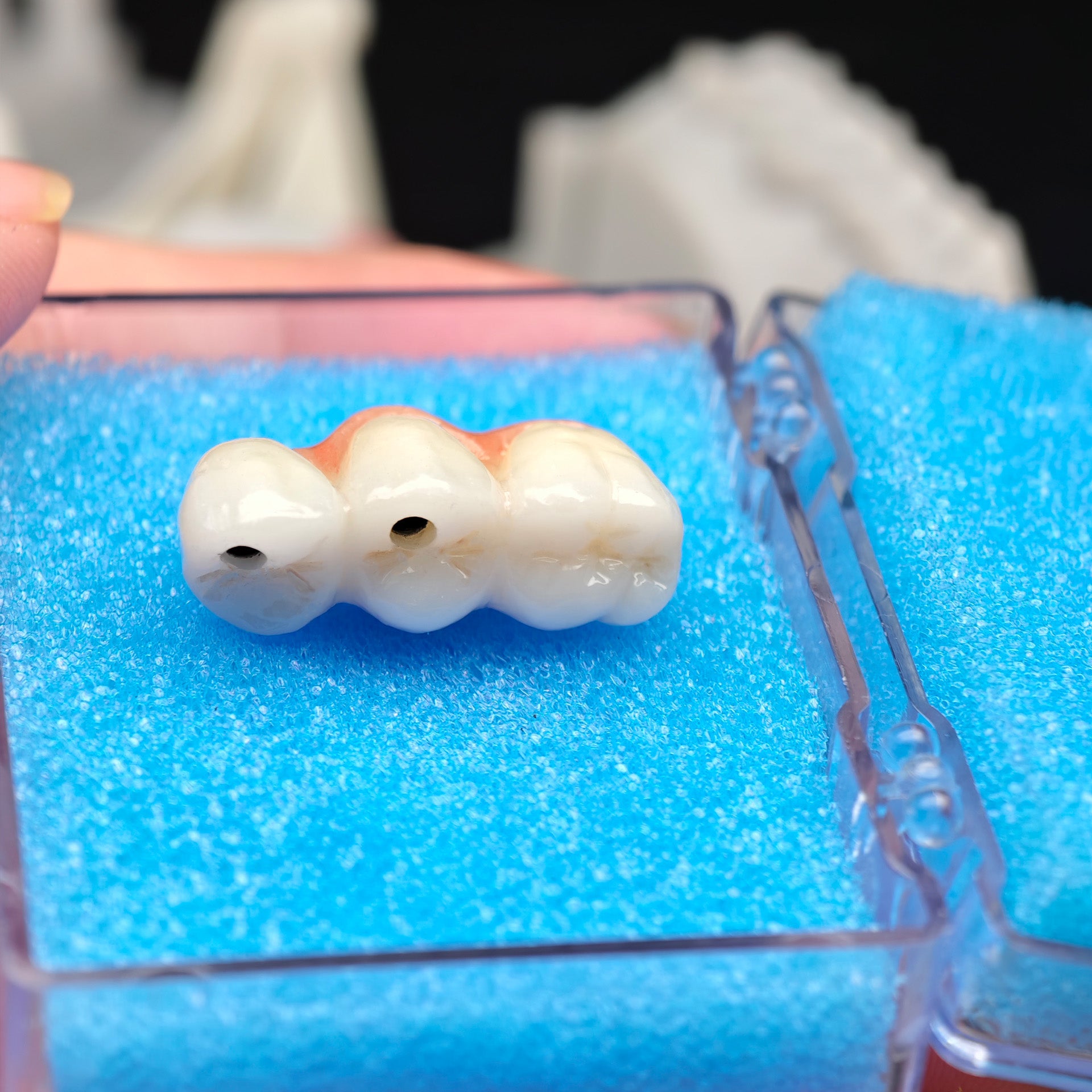 Zirconia Bridge With Screw Retained