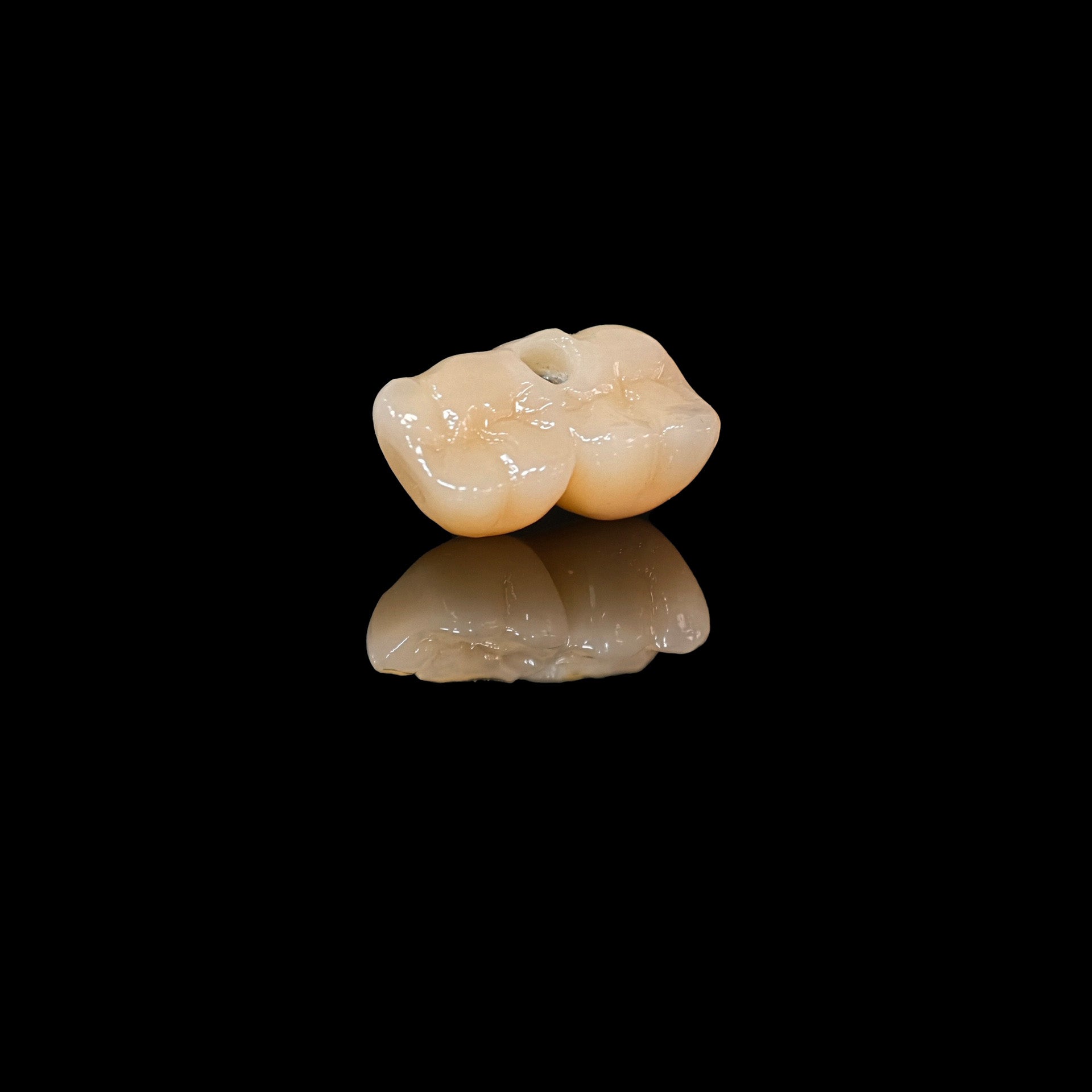 Zirconia Bridge With Screw Retained