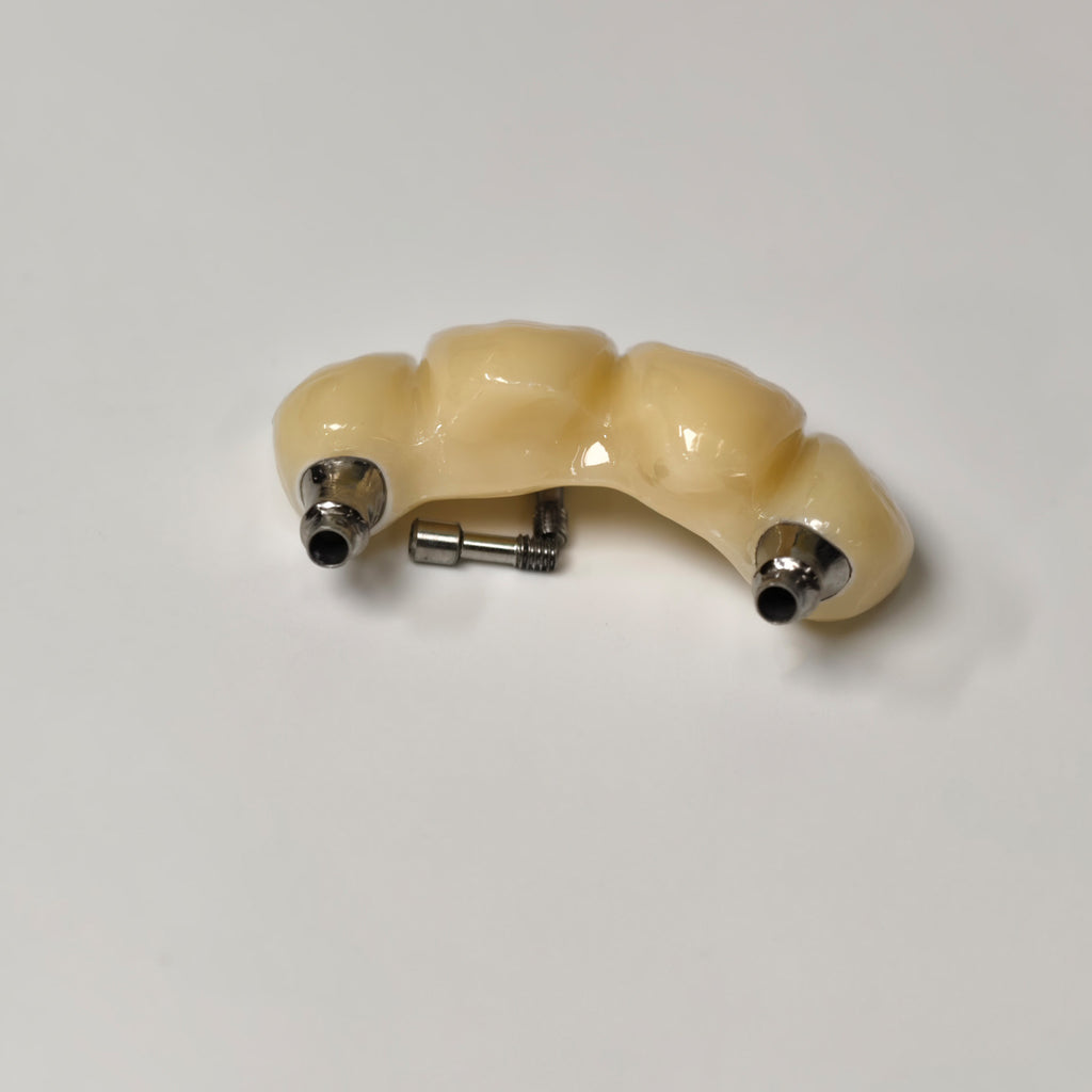 Zirconia Bridge With Screw Retained