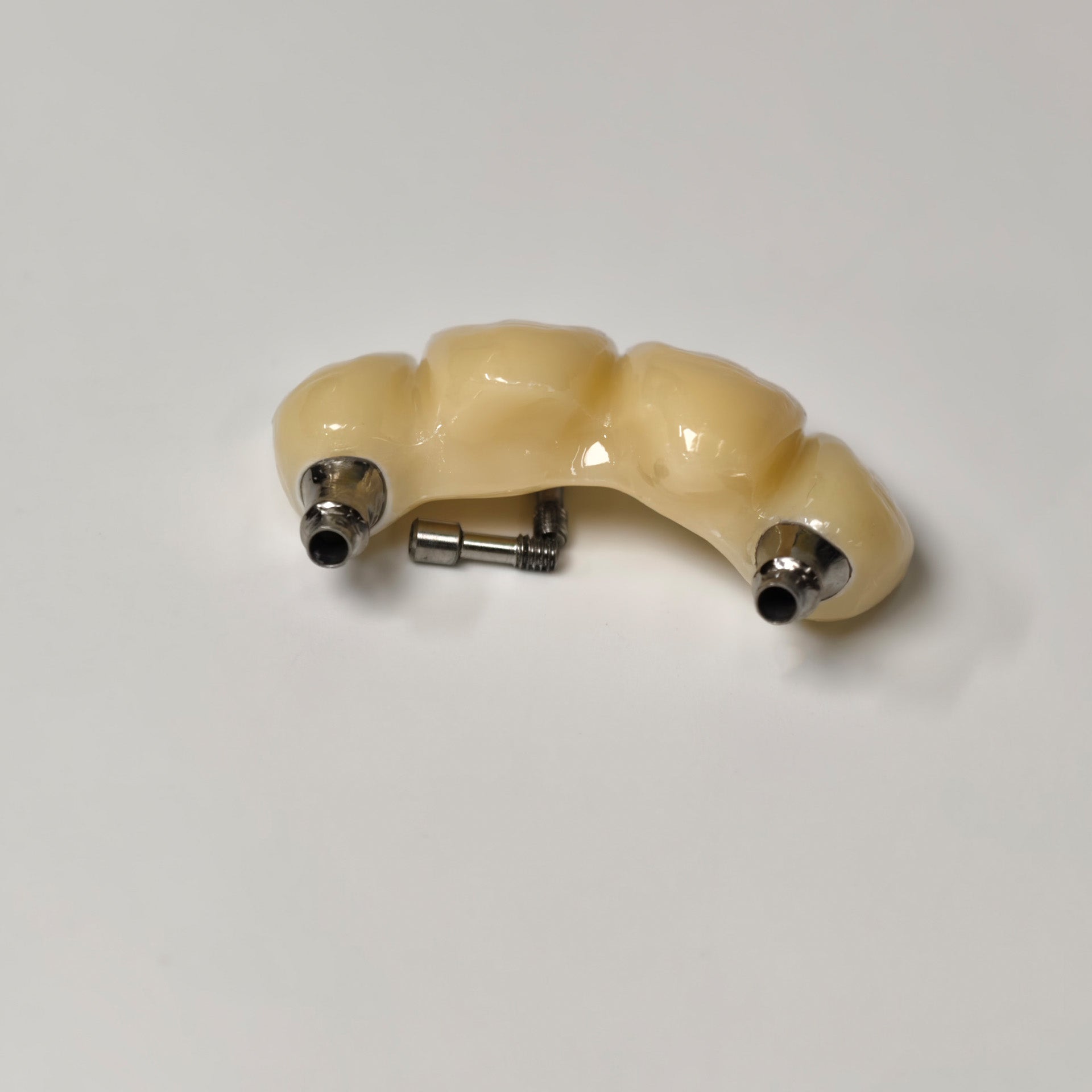 Zirconia Bridge With Screw Retained