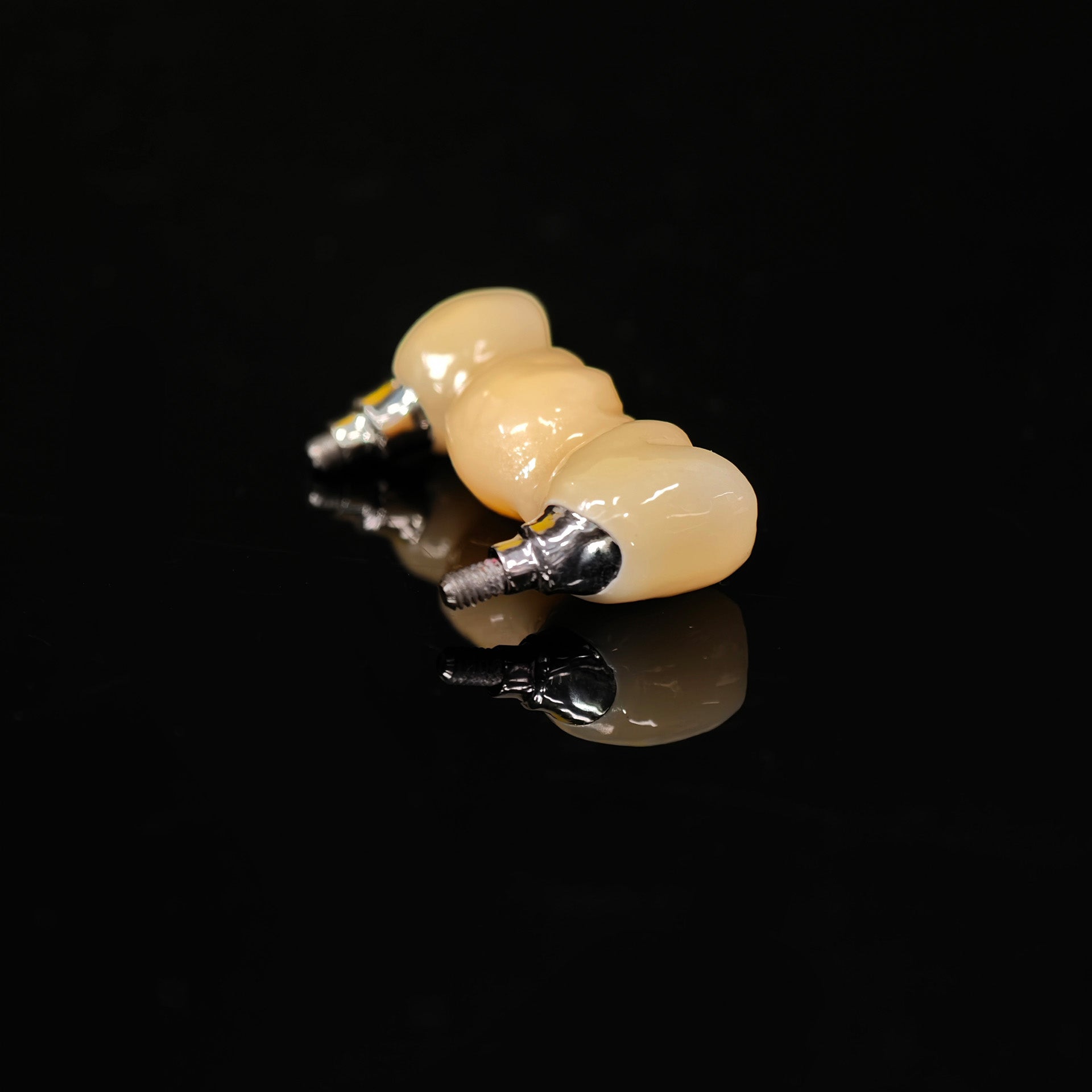 Zirconia Bridge With Screw Retained