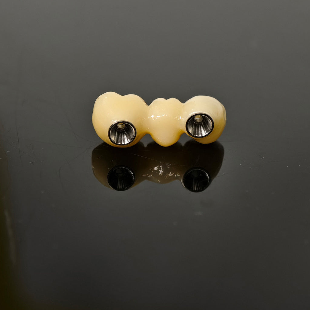 Zirconia Bridge With Ti-Base Screw Retained