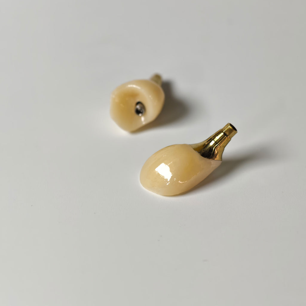 Zirconia Crowns With Gold-Plated Abutment