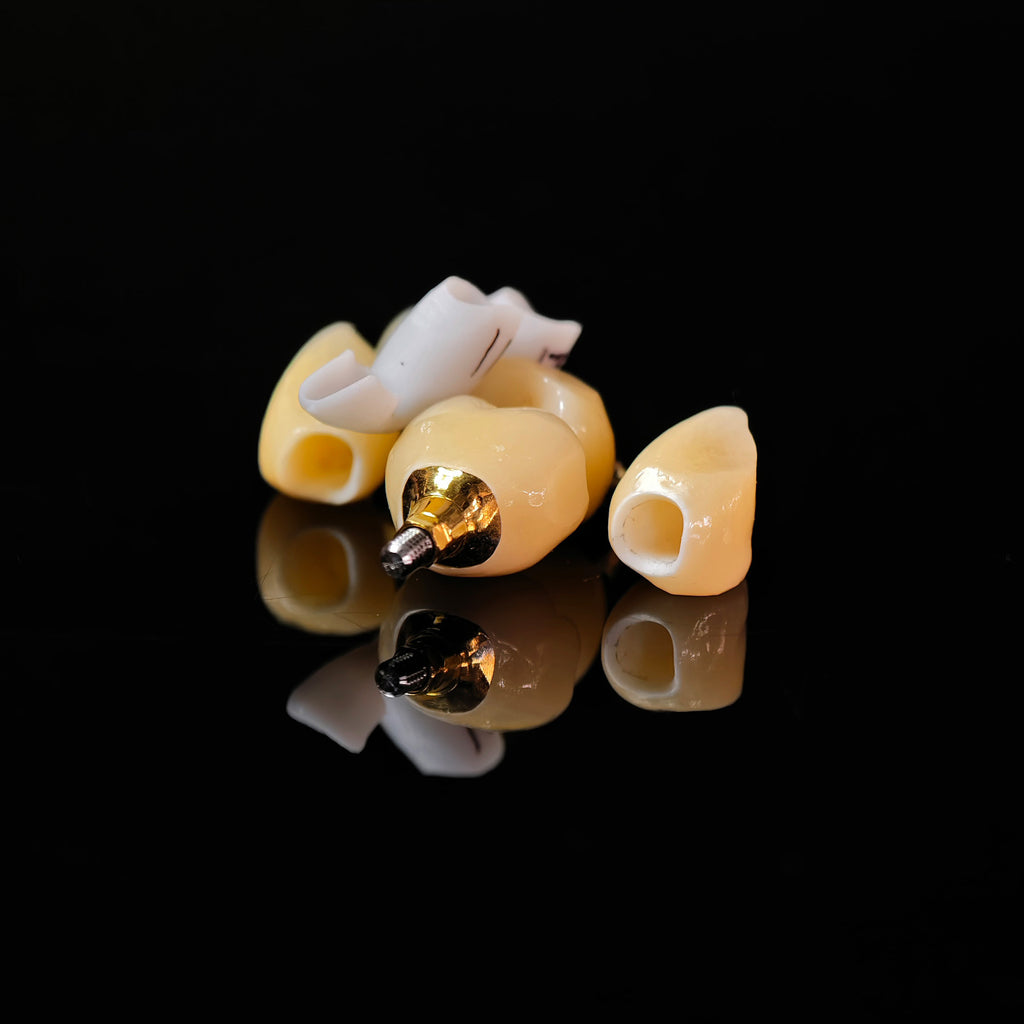 Zirconia Crowns With Gold-Plated Abutment And Implant Seating Guide