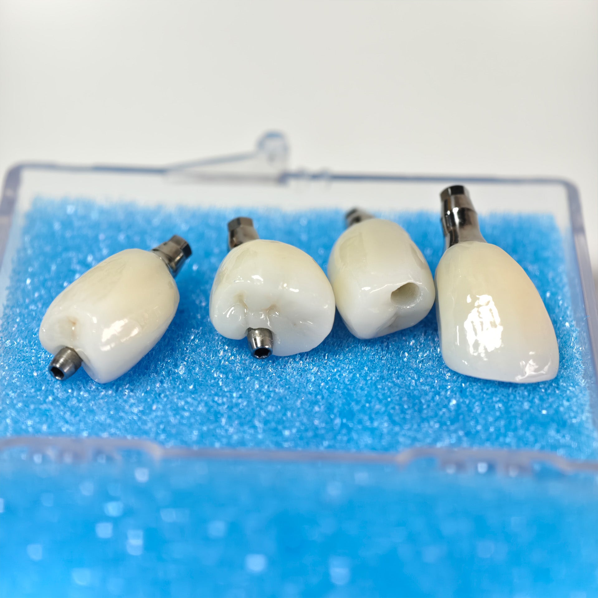 Zirconia Crowns With Screw Retained
