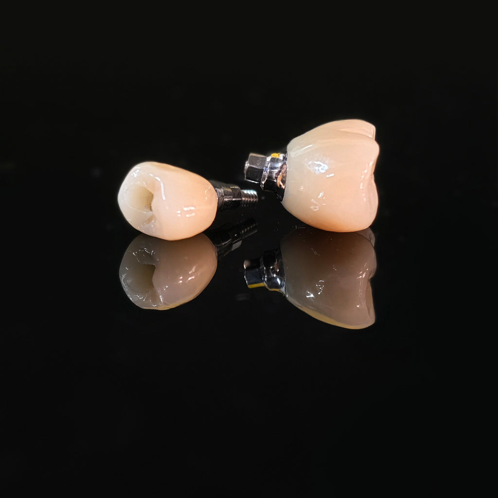 Zirconia Crowns With Screw Retained