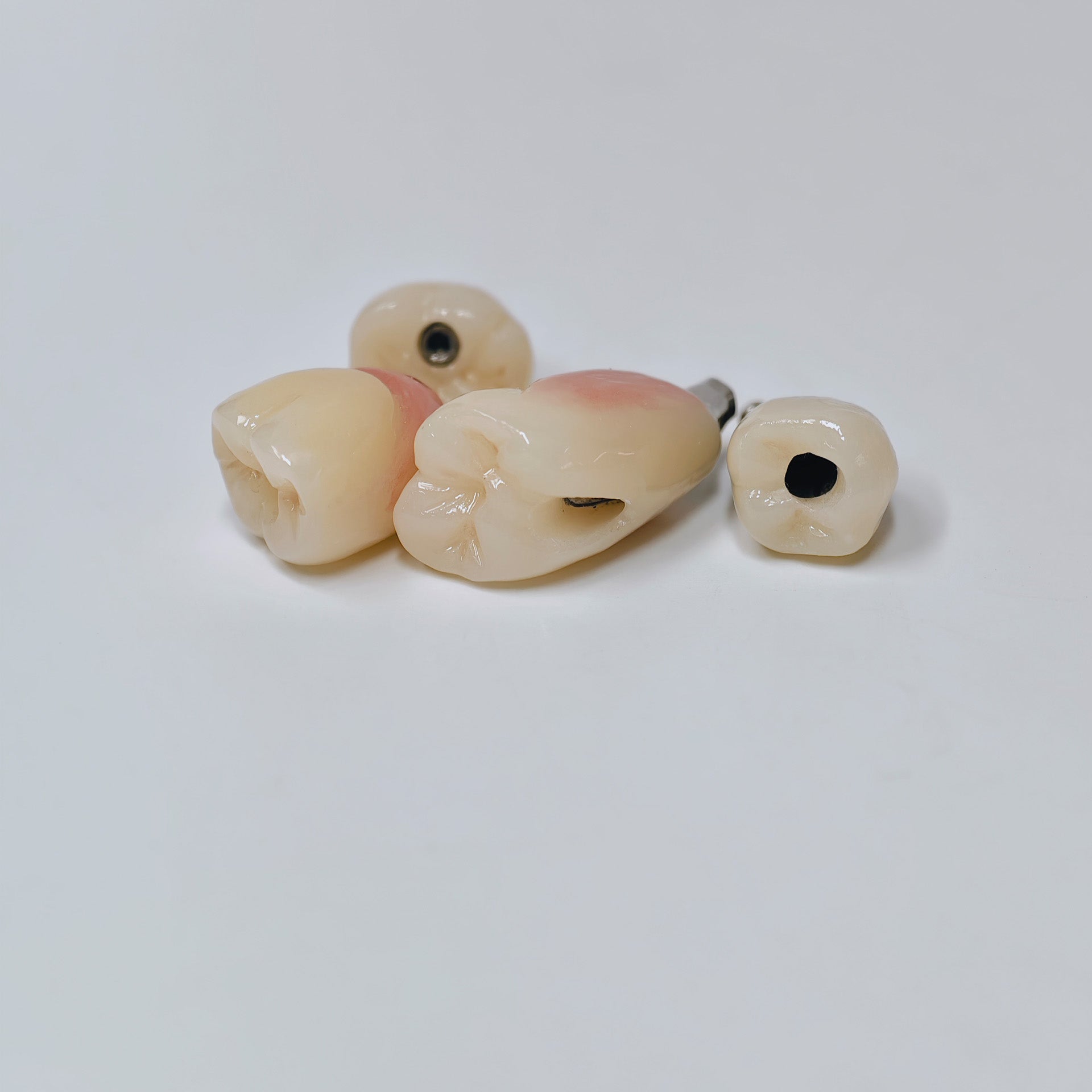 Zirconia Crowns With Screw Retained