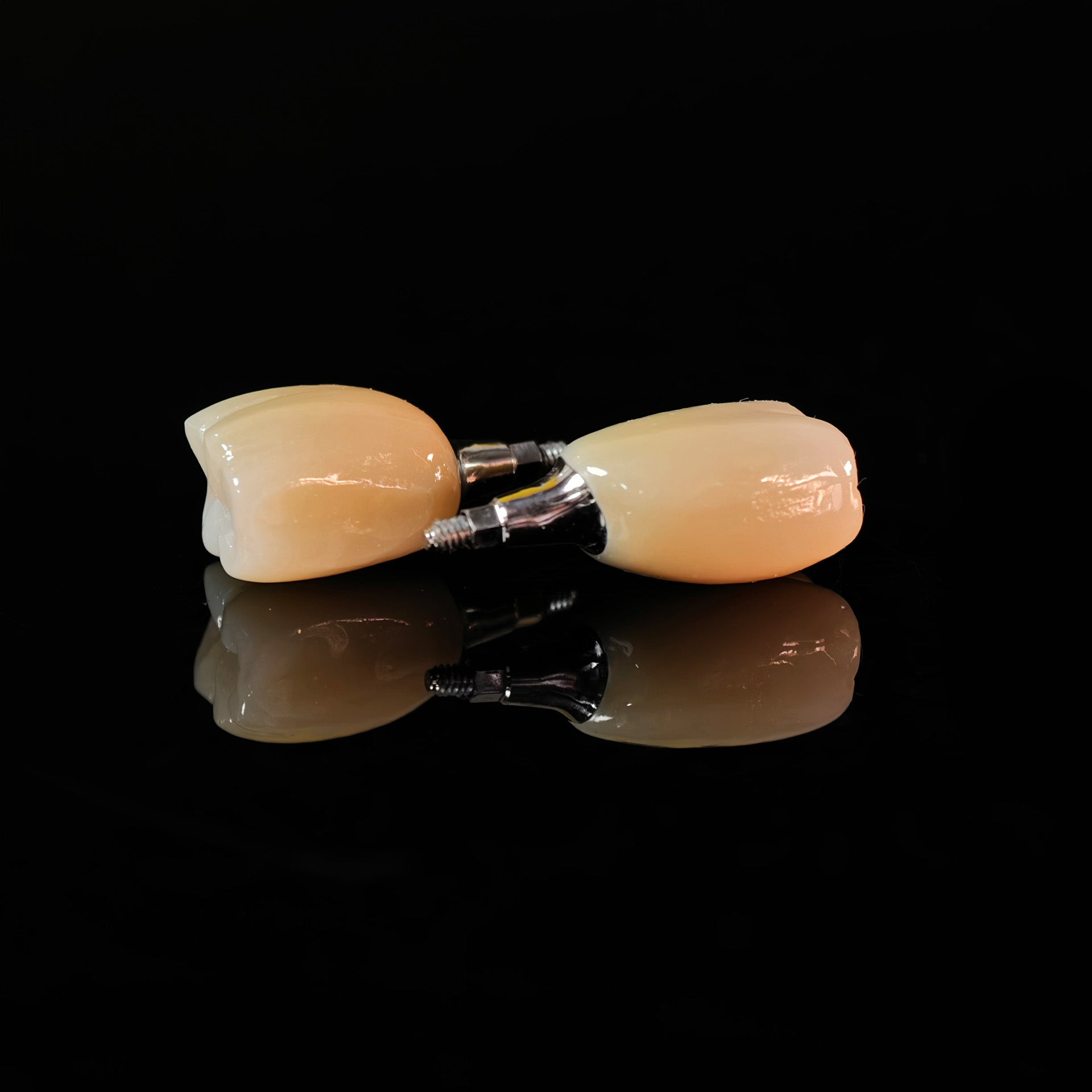 Zirconia Crowns With Screw Retained