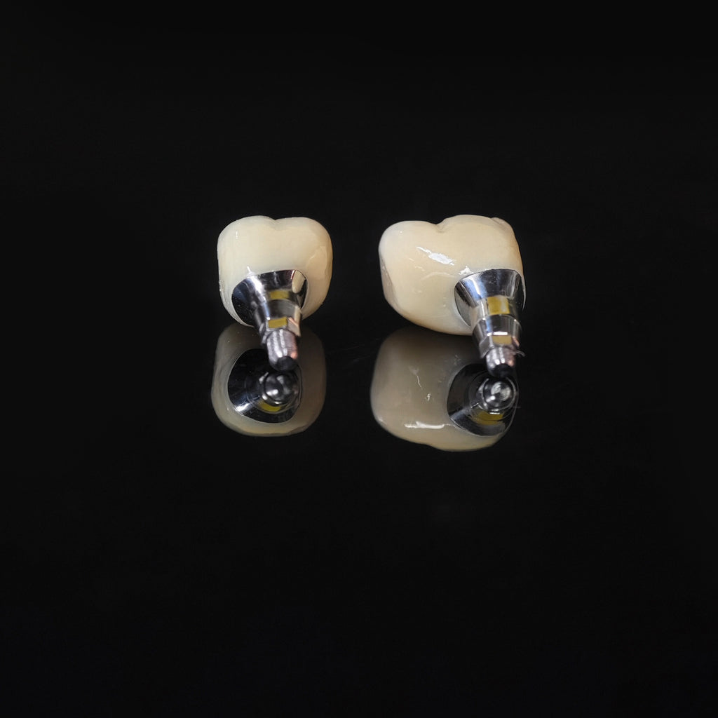 Zirconia Crowns With Screw Retained