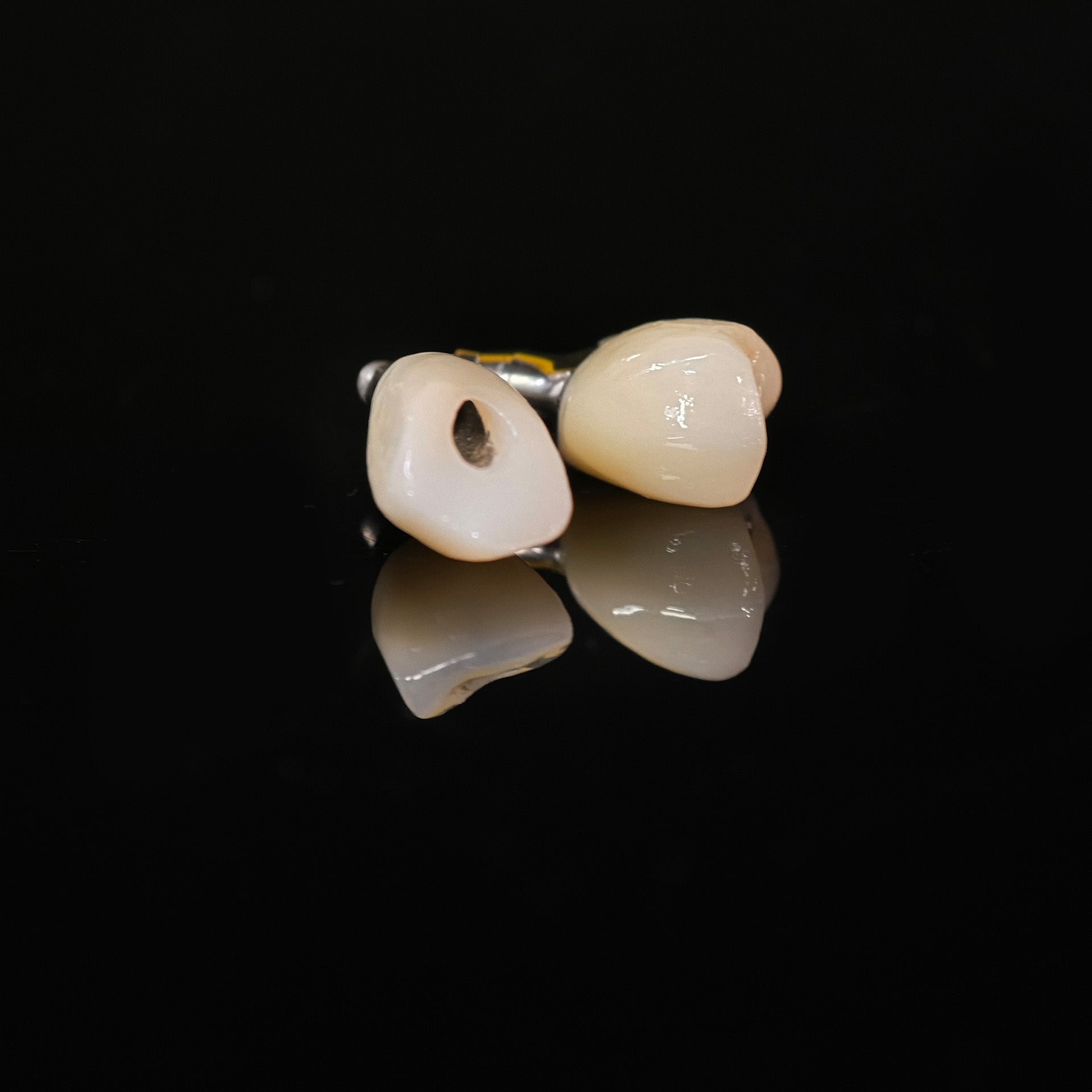 Zirconia Crowns With Screw Retained