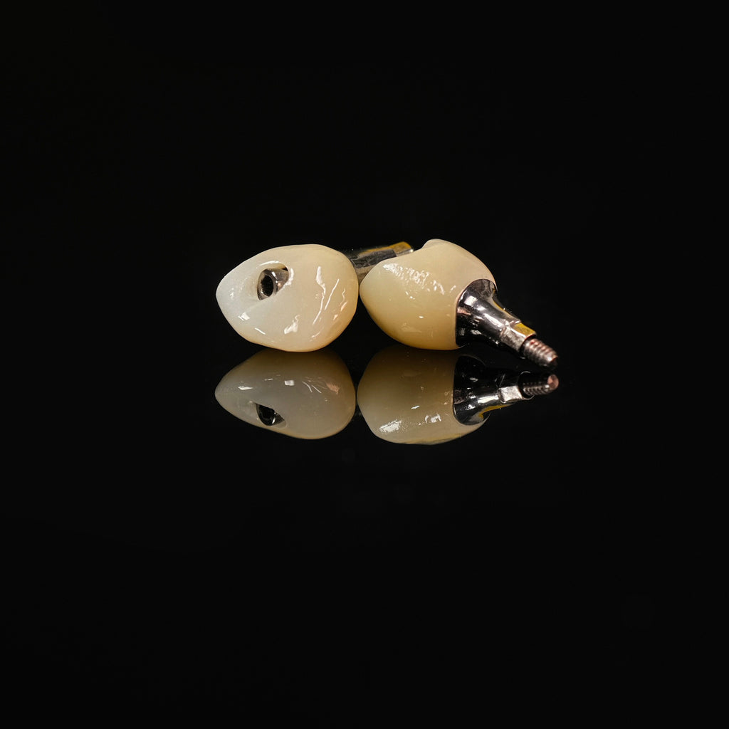 Zirconia Crowns With Screw Retained