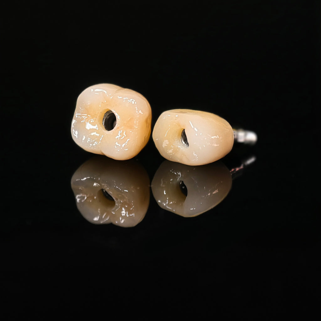 Zirconia Crowns With Screw Retained