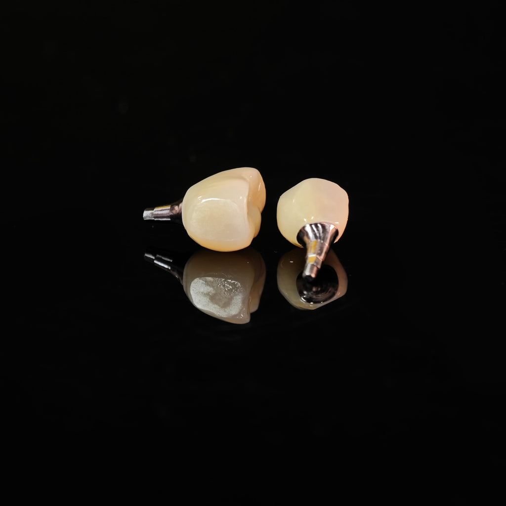 Zirconia Crowns With Screw Retained