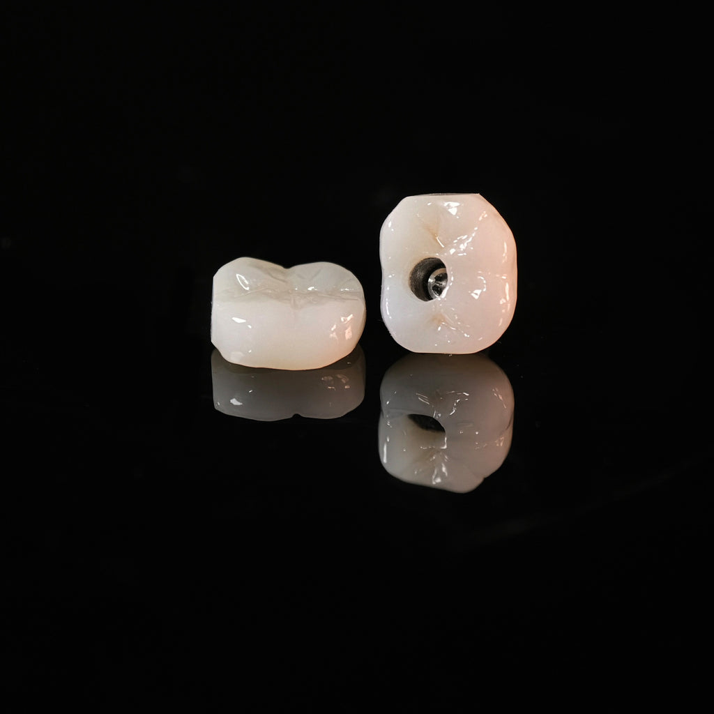 Zirconia Crowns With Screw Retained And Cement Retained
