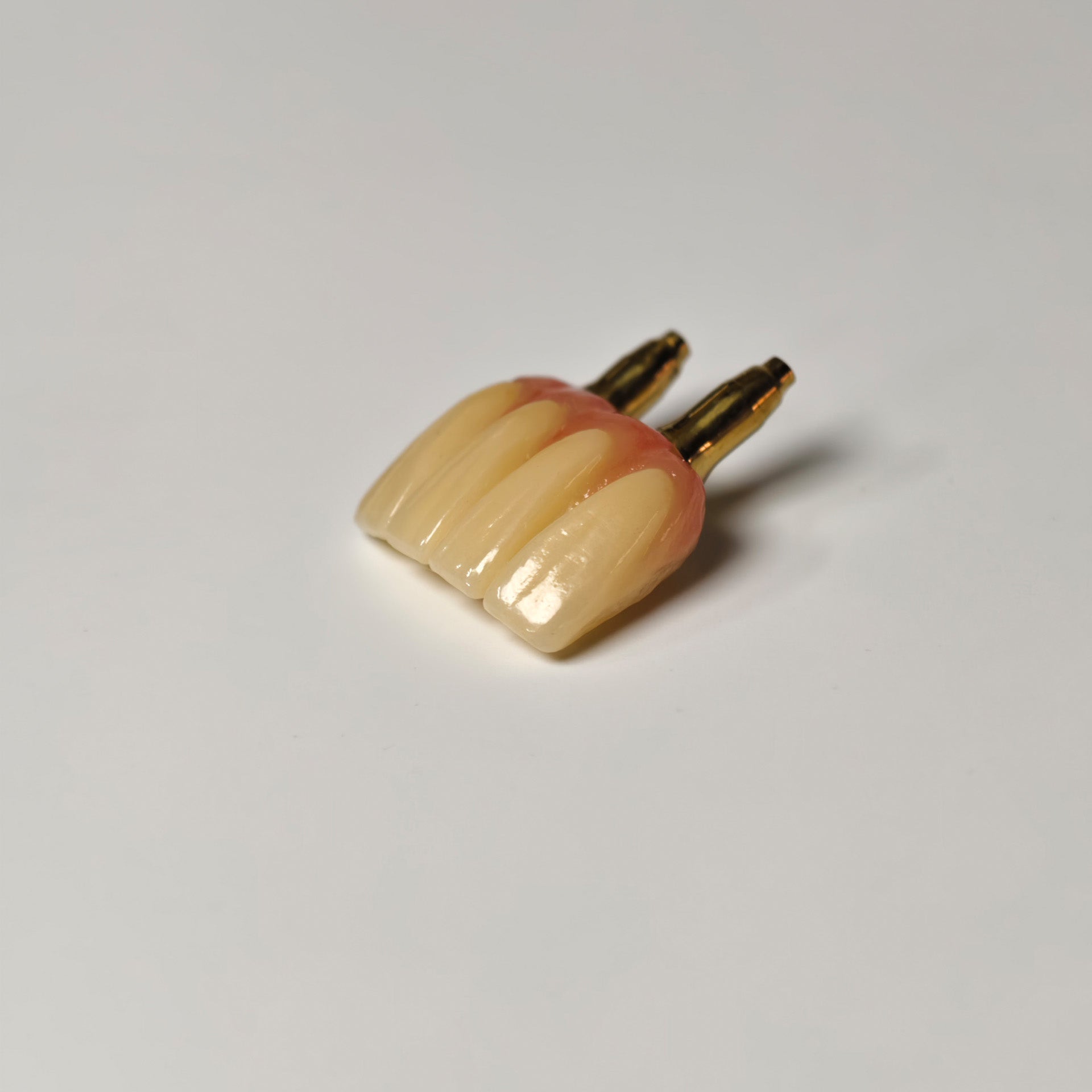 Zirconia Crown With Gold-Plated Abutment