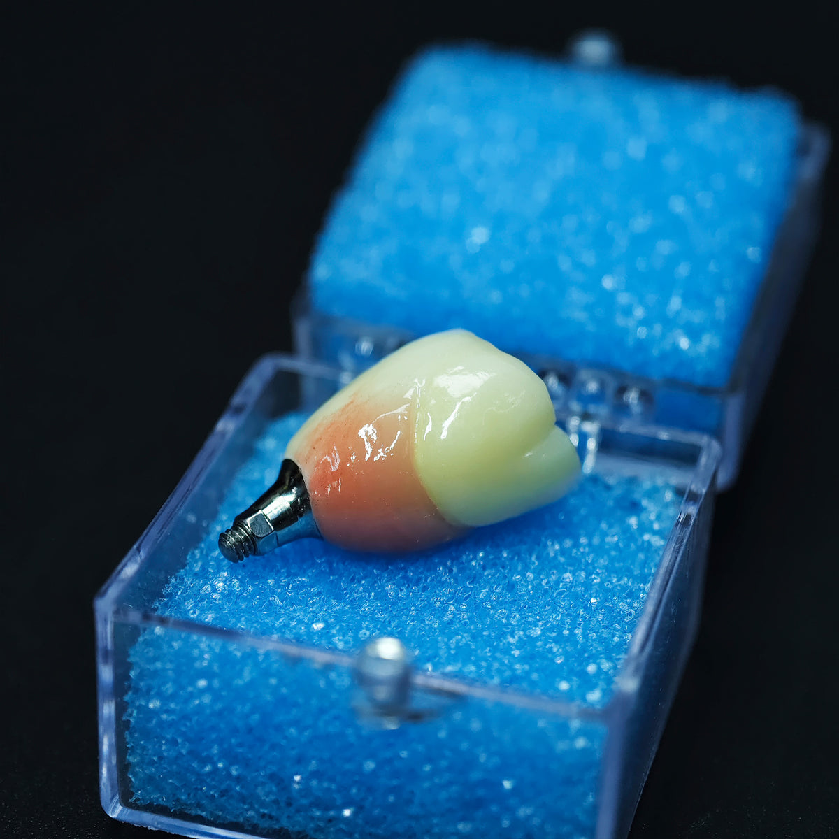 Zirconia Crown With Screw Retained