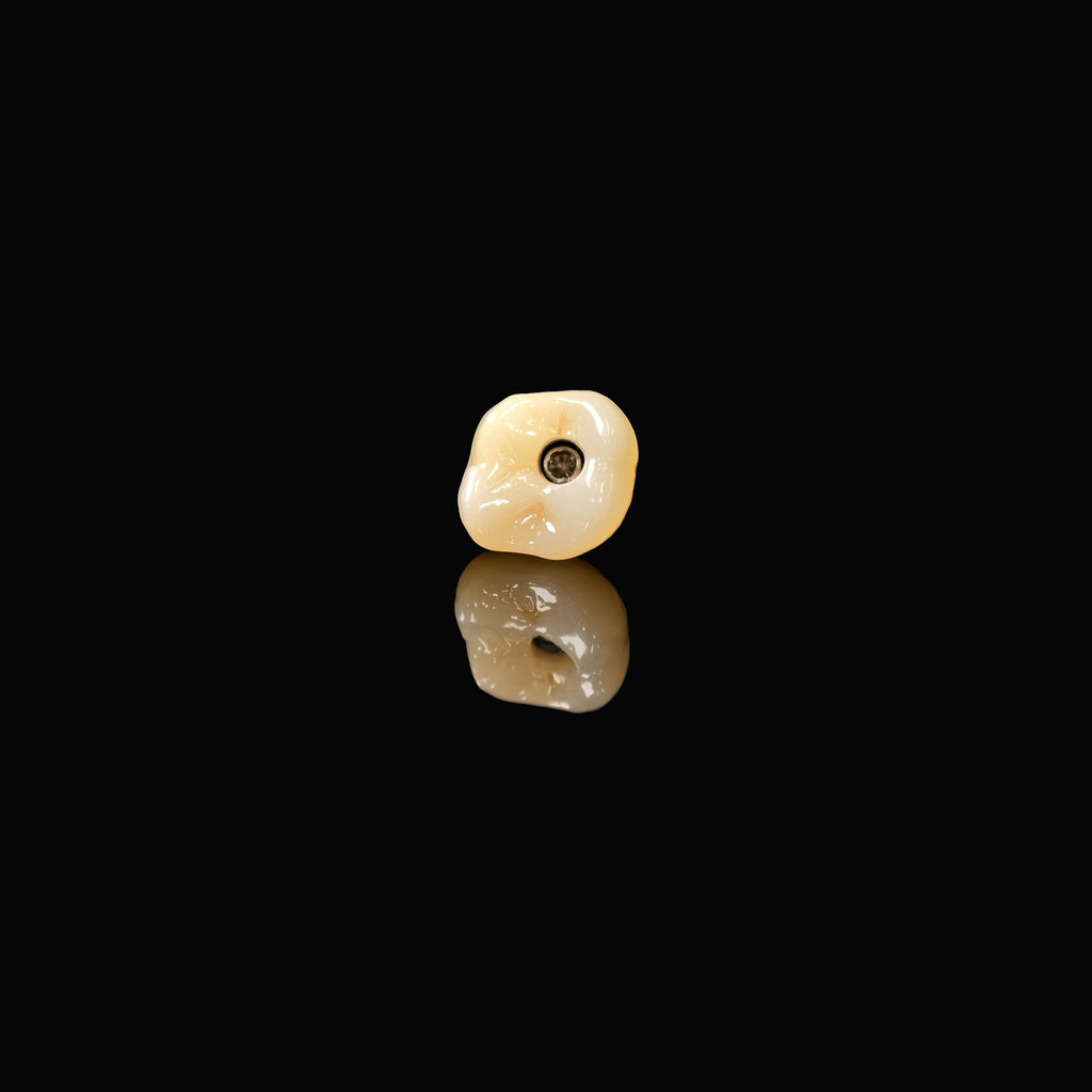 Zirconia Crown With Screw Retained