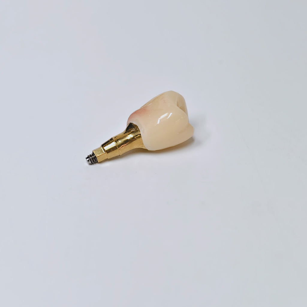 Zirconia Crown With Screw Retained