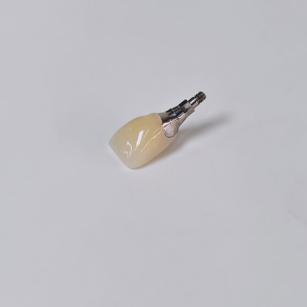 Zirconia Crown With Screw Retained