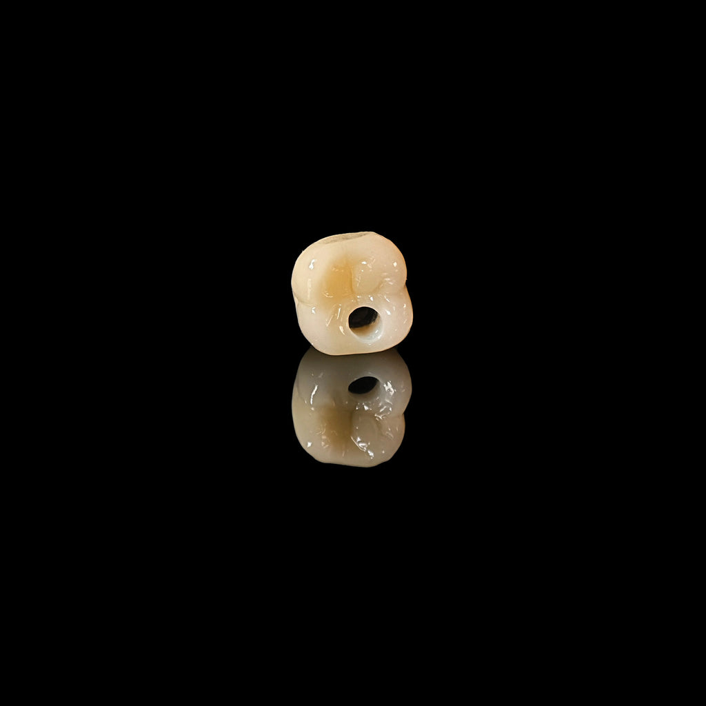 Zirconia Crown With Screw Retained