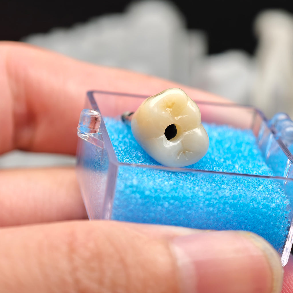 Zirconia Crown With Screw Retained