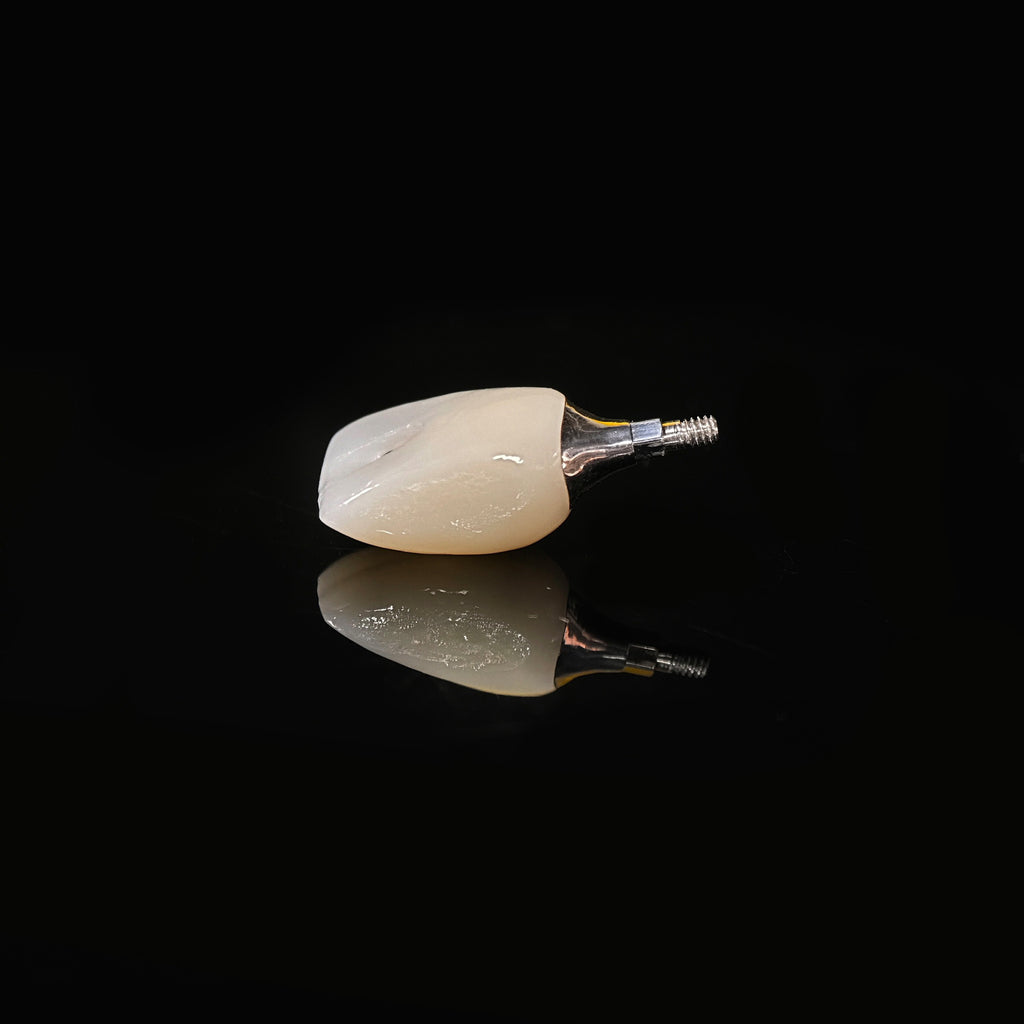 Zirconia Crown With Screw Retained