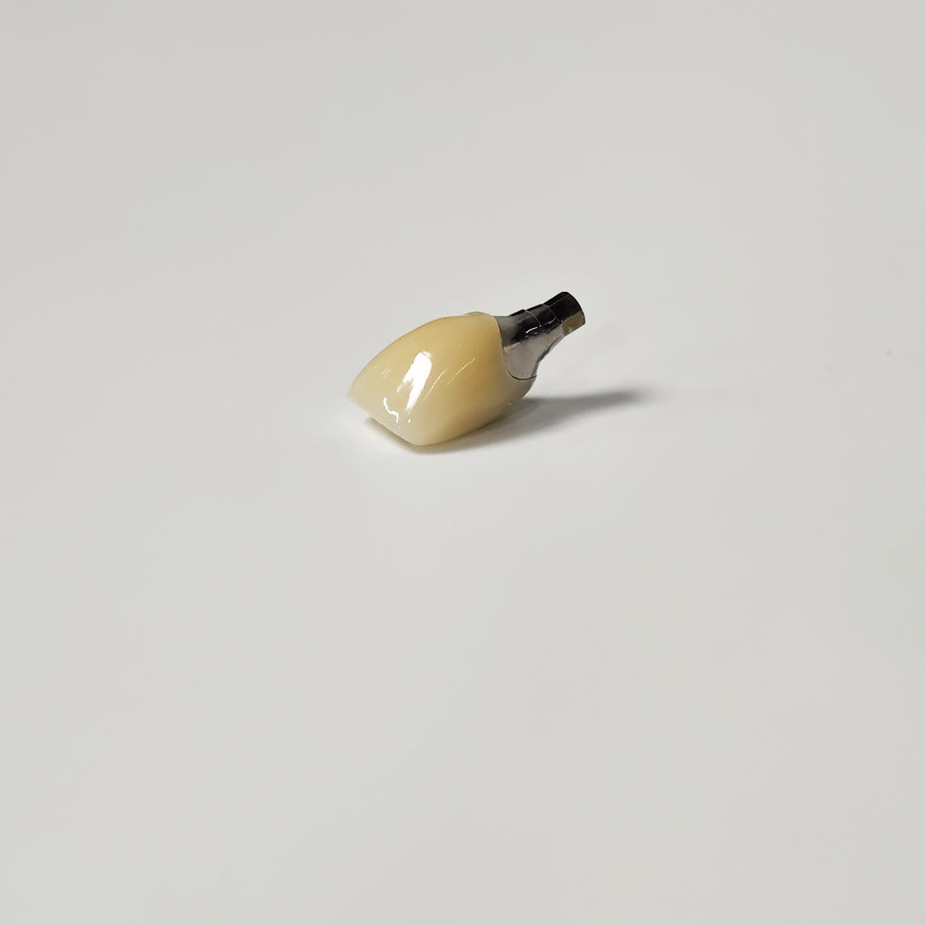Zirconia Crown With Screw Retained