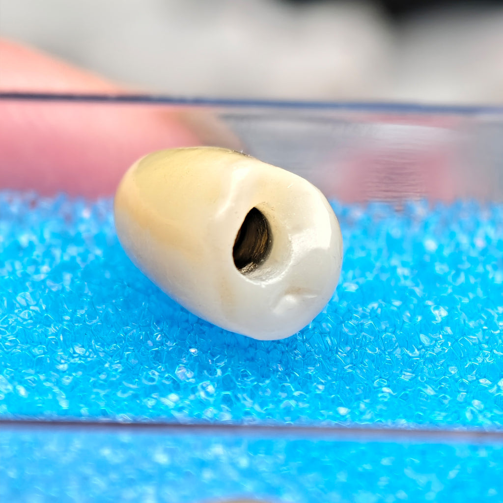Zirconia Crown With Screw Retained