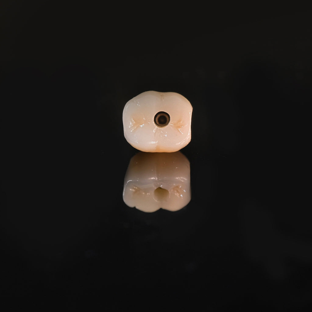 Zirconia Crown With Screw Retained