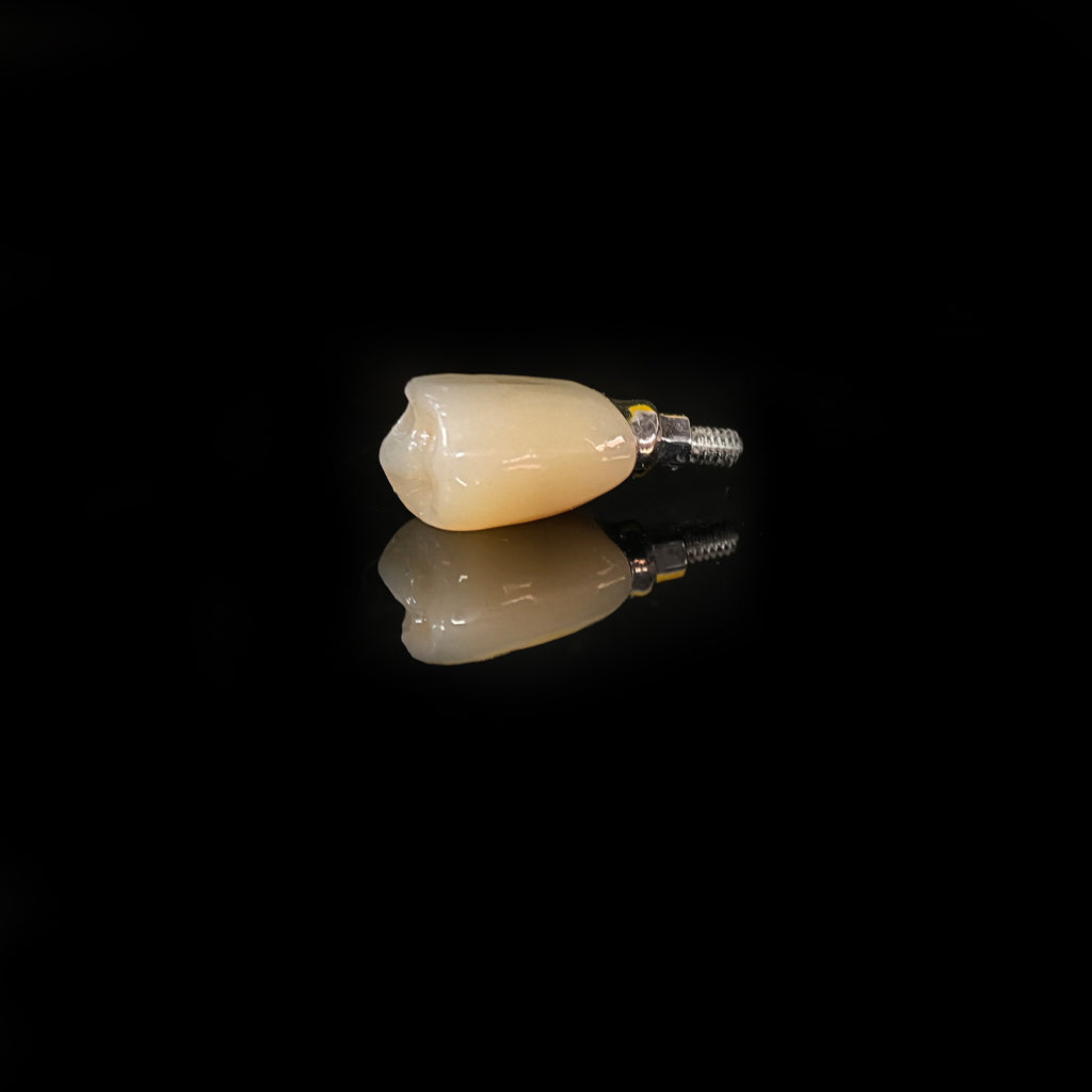 Zirconia Crown With Screw Retained