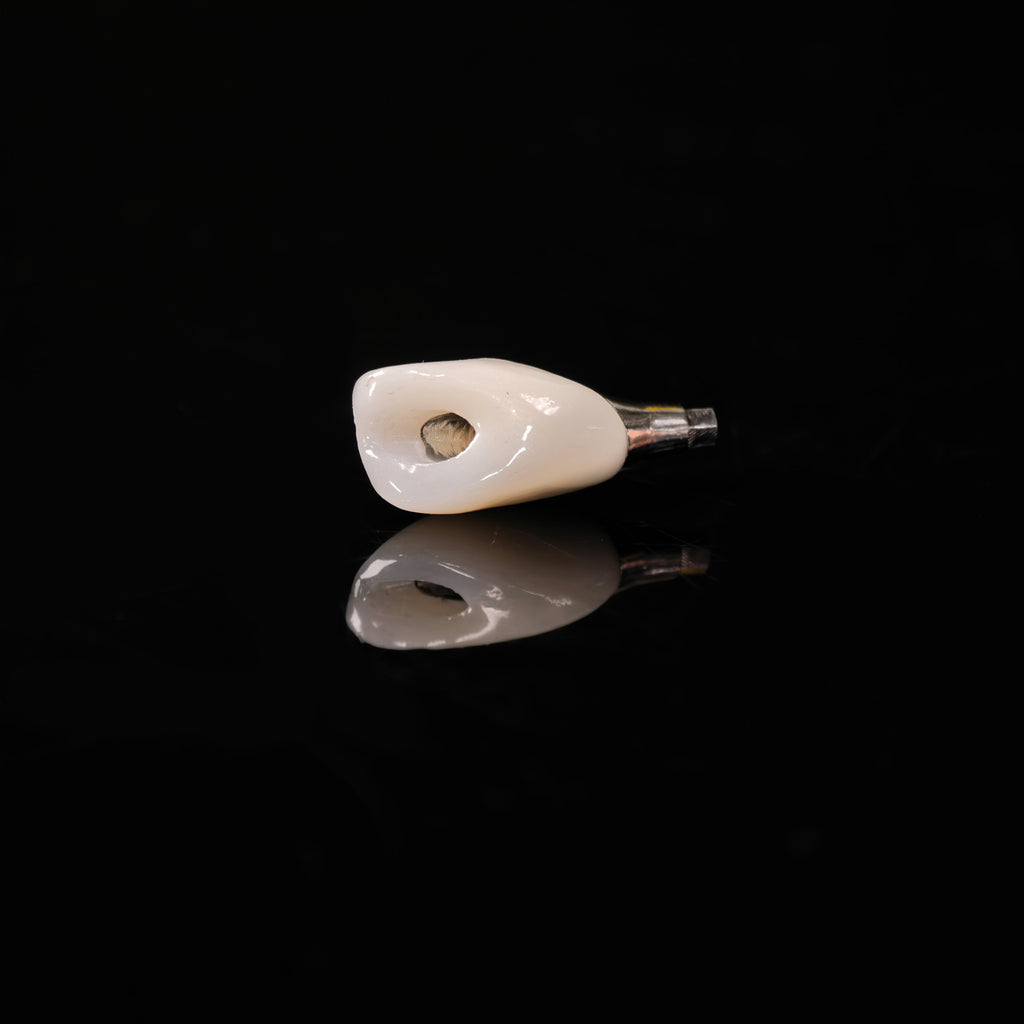 Zirconia Crown With Screw Retained