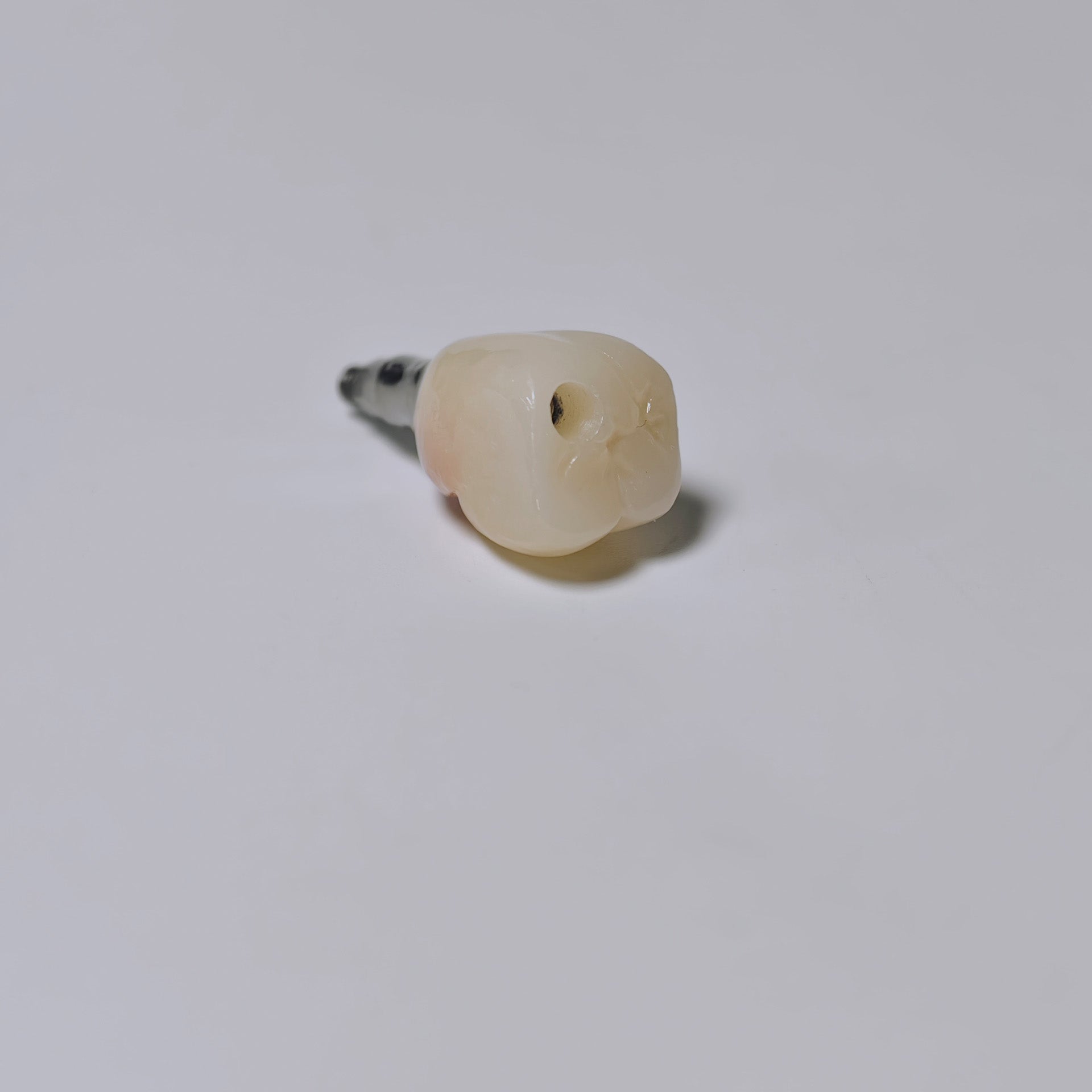 Zirconia Crown With Screw Retained
