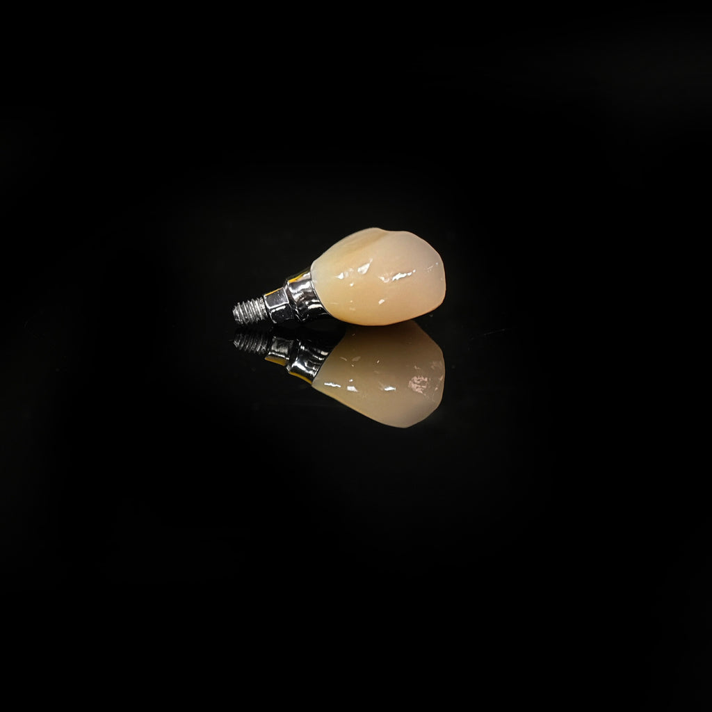 Zirconia Crown With Screw Retained