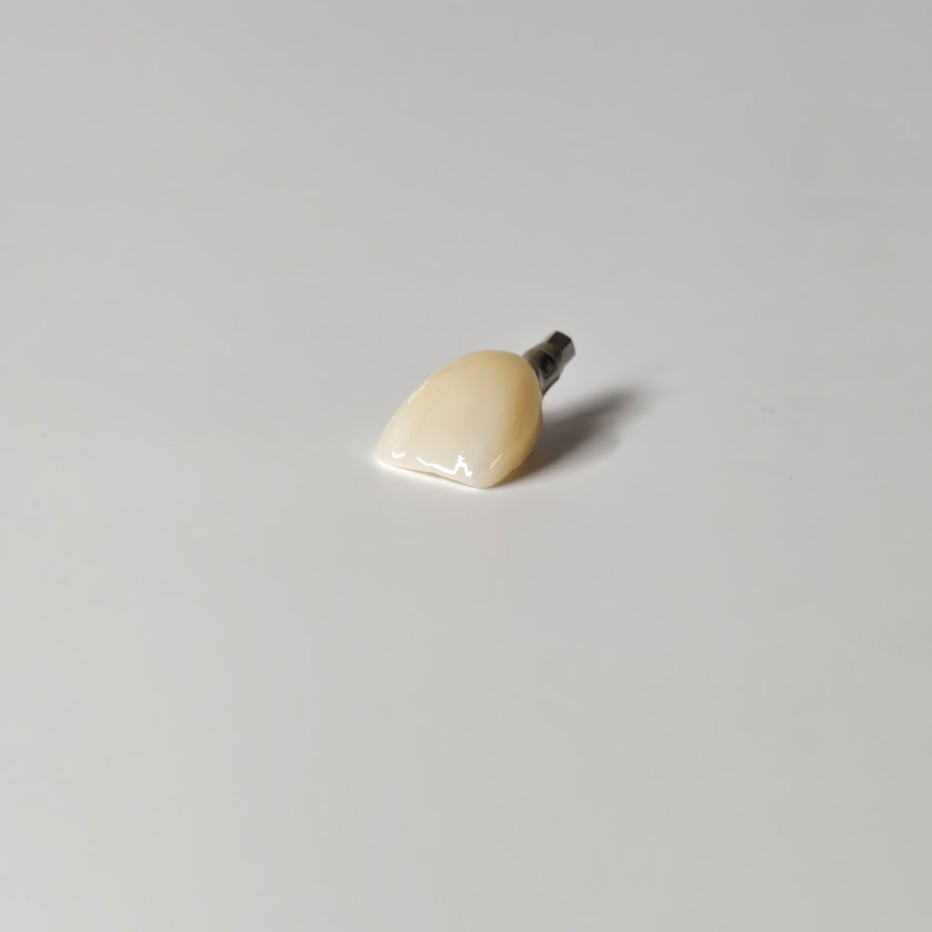 Zirconia Crown With Screw Retained