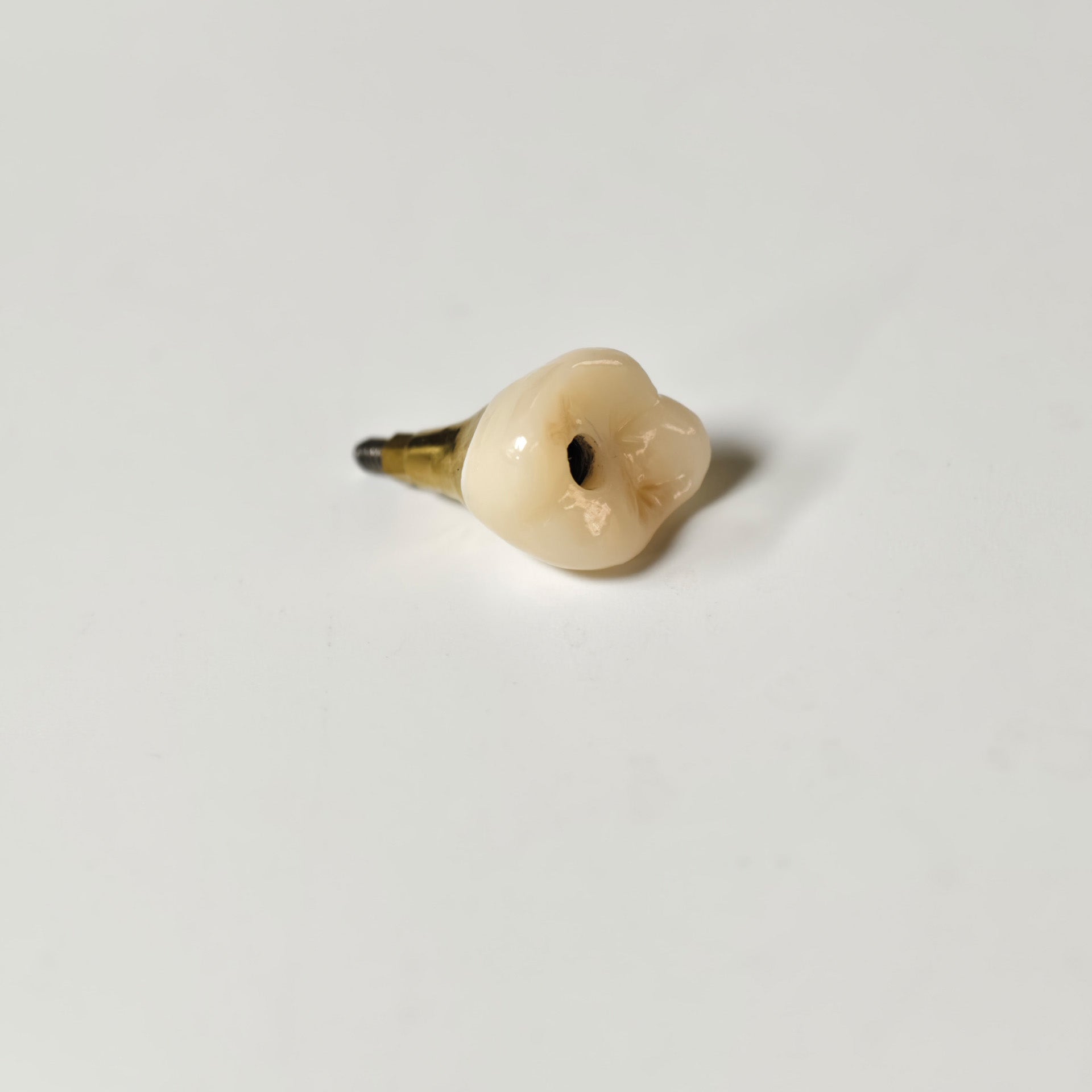 Zirconia Crown With Screw Retained