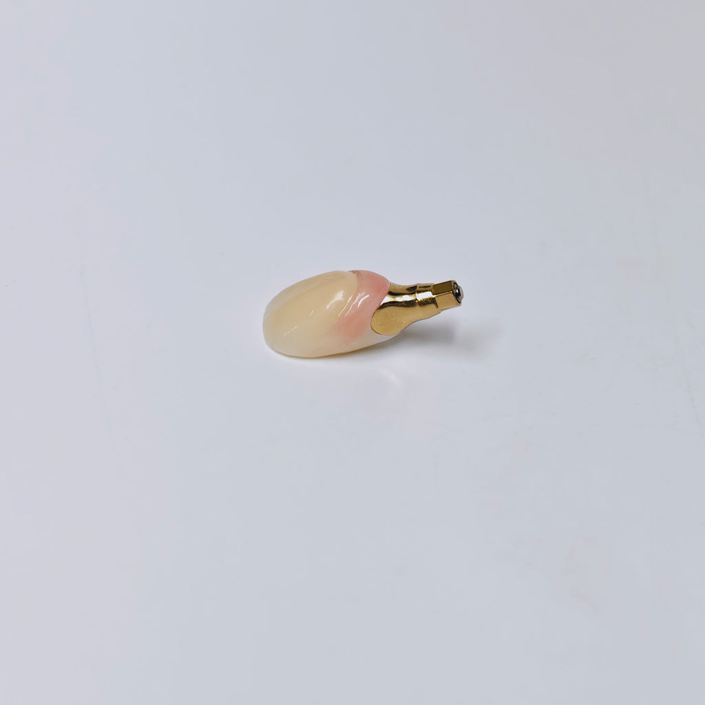 Zirconia Crown With Screw Retained