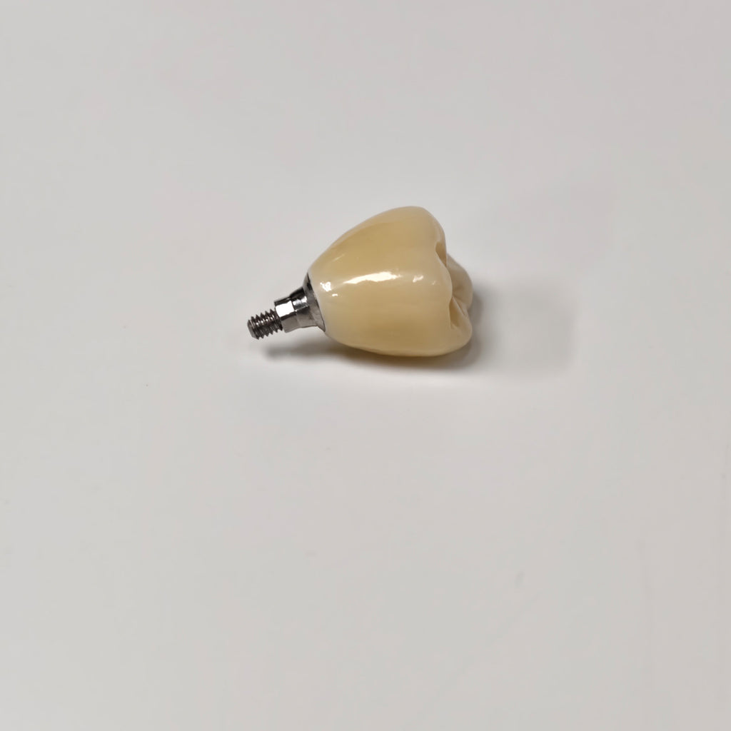 Zirconia Crown With Screw Retained