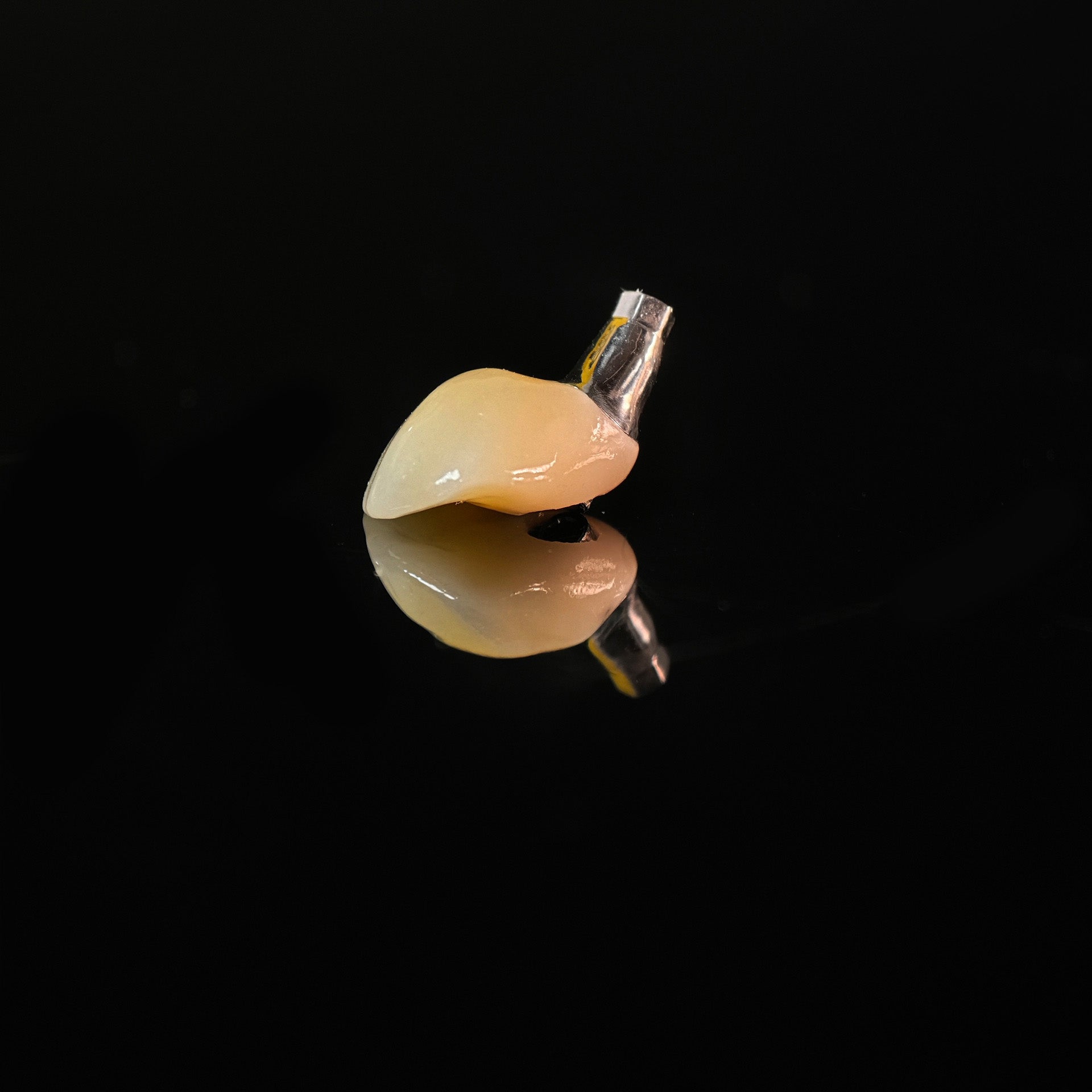 Zirconia Crown With Screw Retained