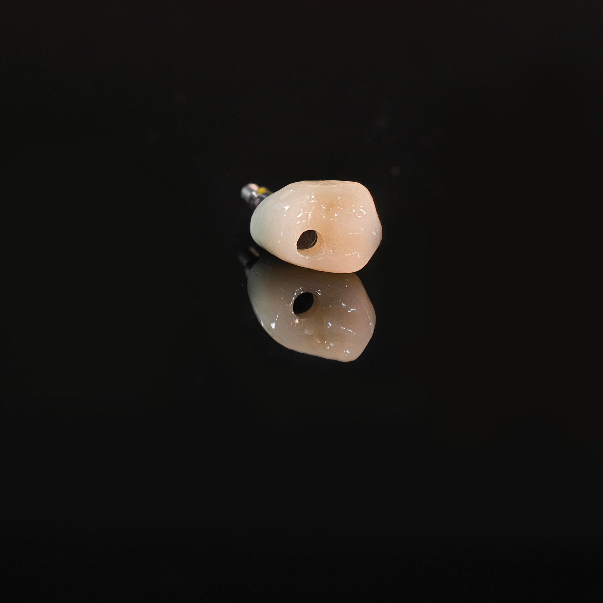 Zirconia Crown With Screw Retained