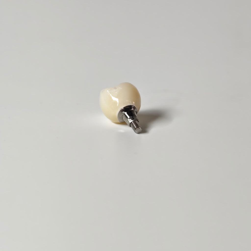 Zirconia Crown With Screw Retained