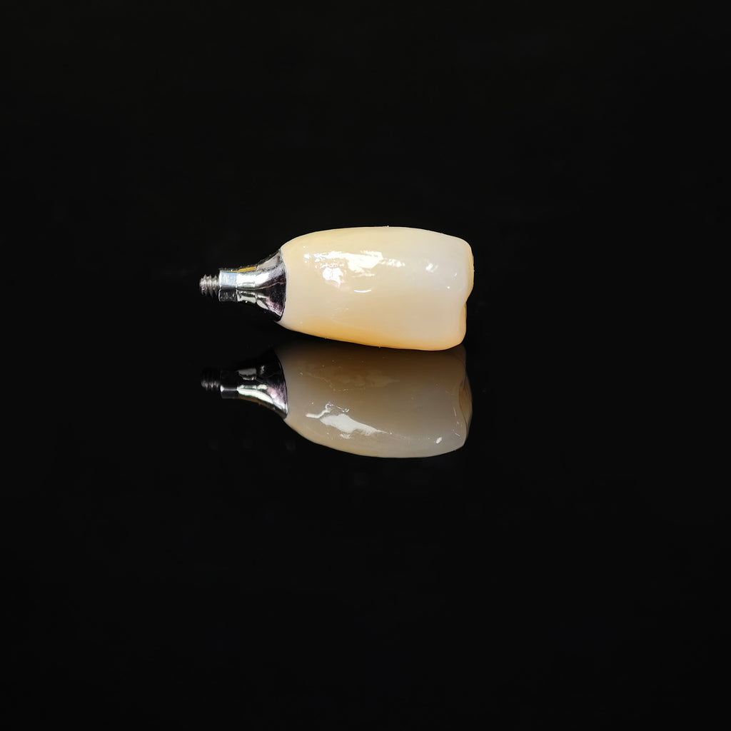 Zirconia Crown With Screw Retained