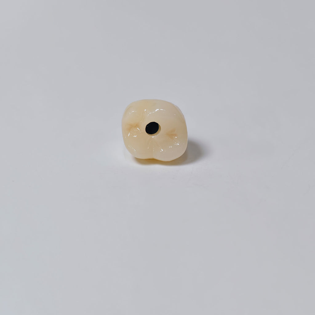 Zirconia Crown With Screw Retained