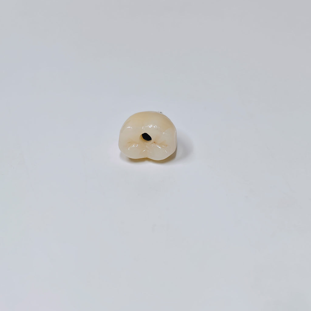 Zirconia Crown With Screw Retained