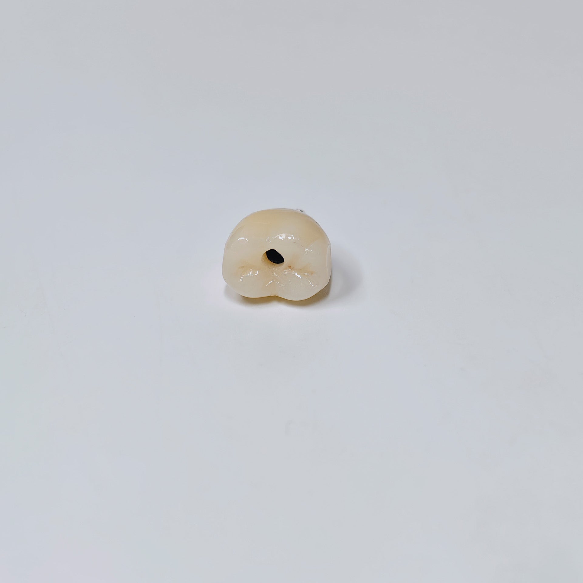 Zirconia Crown With Screw Retained