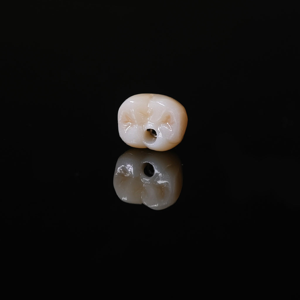 Zirconia Crown With Screw Retained