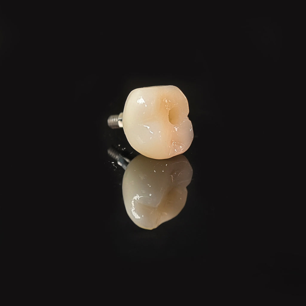 Zirconia Crown With Screw Retained