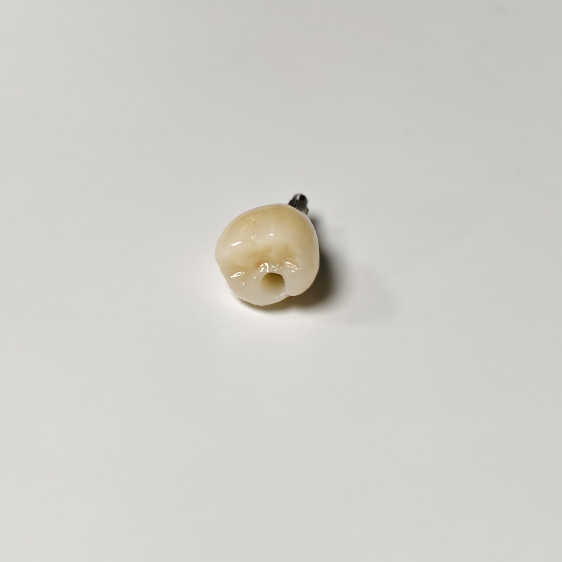 Zirconia Crown With Screw Retained