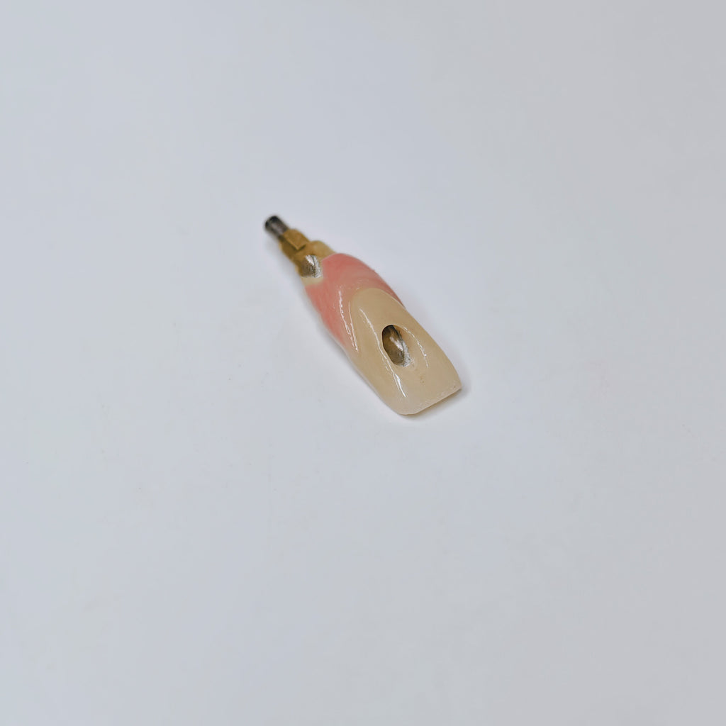 Zirconia Crown With Screw Retained