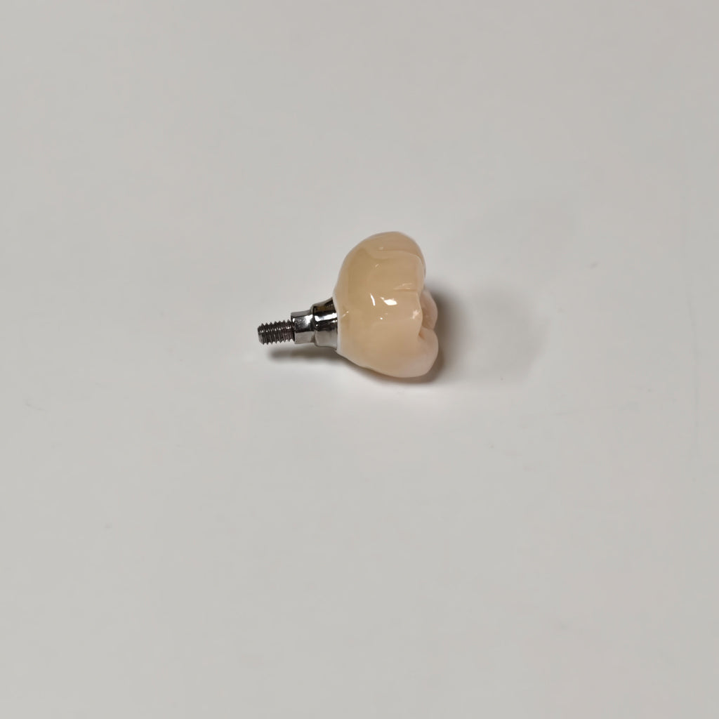 Zirconia Crown With Screw Retained